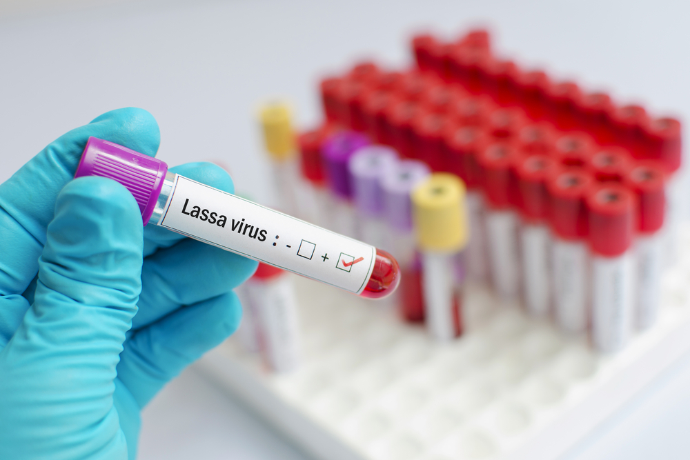 NCDC Alerts Nigerians On High Risk Of Lassa Fever Transmission