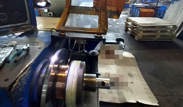 Pregnant Woman Whose Hair Got Tangled In A Machine Dies 5 Days After