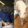 Scientists Revive Organs In Dead Pigs - A Potential Breakthrough For Human Organs Transplant