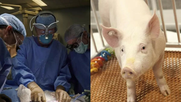 Scientists Revive Organs In Dead Pigs - A Potential Breakthrough For Human Organs Transplant