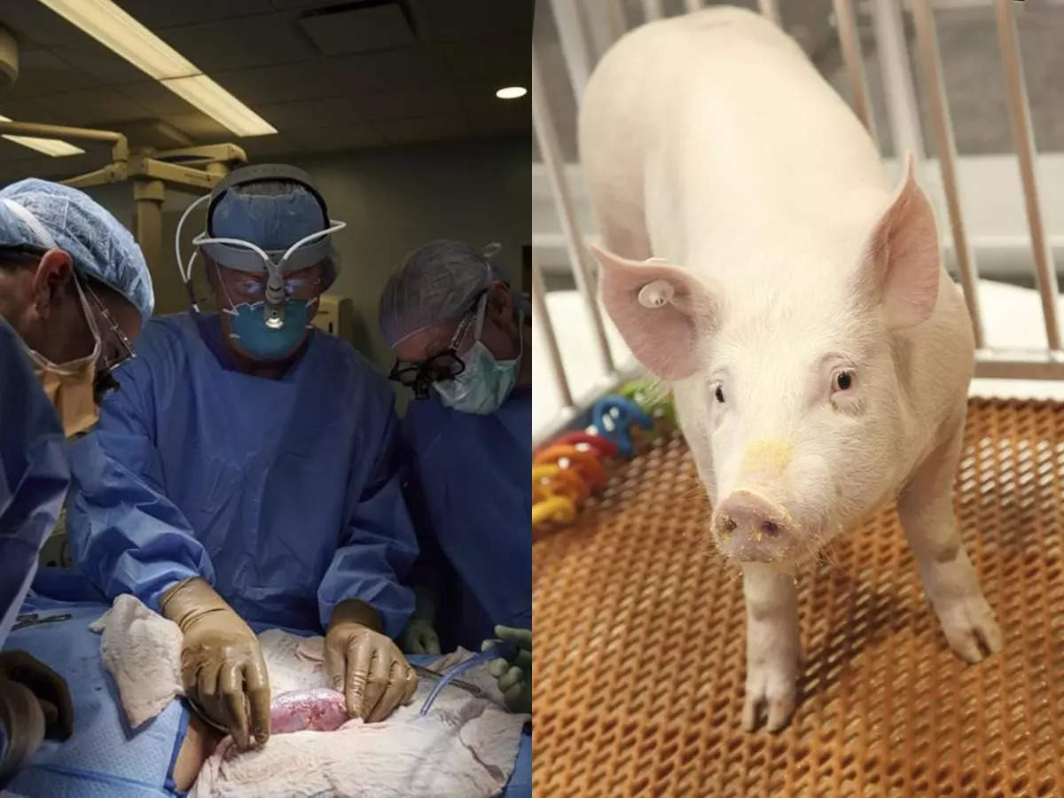 Scientists Revive Organs In Dead Pigs - A Potential Breakthrough For Human Organs Transplant