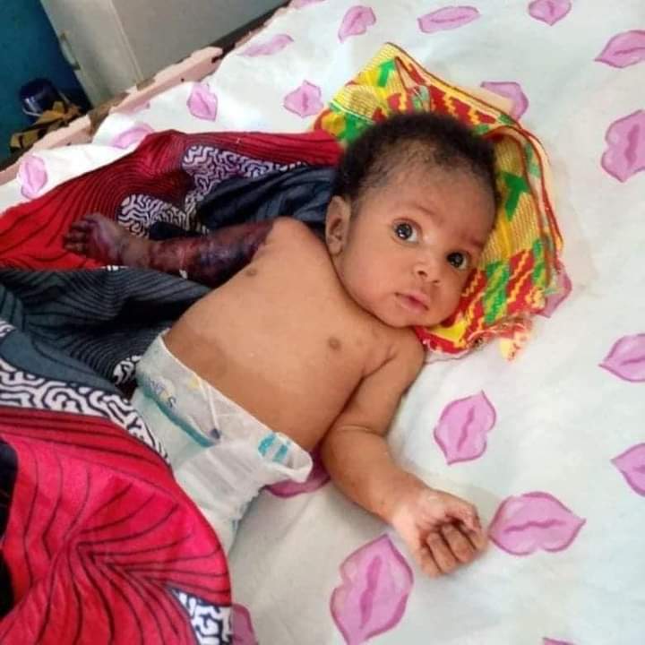 PHOTOS: Father Breaks 2-Month-old Baby's Hand For Disturbing His Sleep