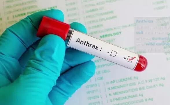 FG Confirms First Case Of Anthrax In Nigeria