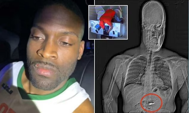 Man Swallows Stolen Earrings Worth Over Half A Million Dollars Before Arrest
