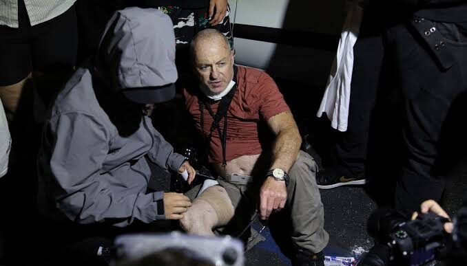 British Photographer Injured By Non-Lethal Bullet In LA Protest
