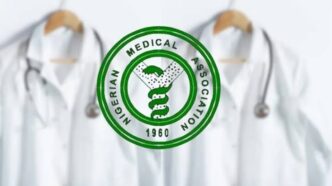 NMA