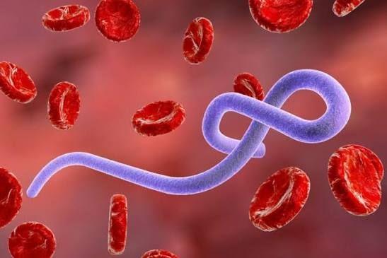 Ebola Reaches France As Returning Doctor Tests Positive